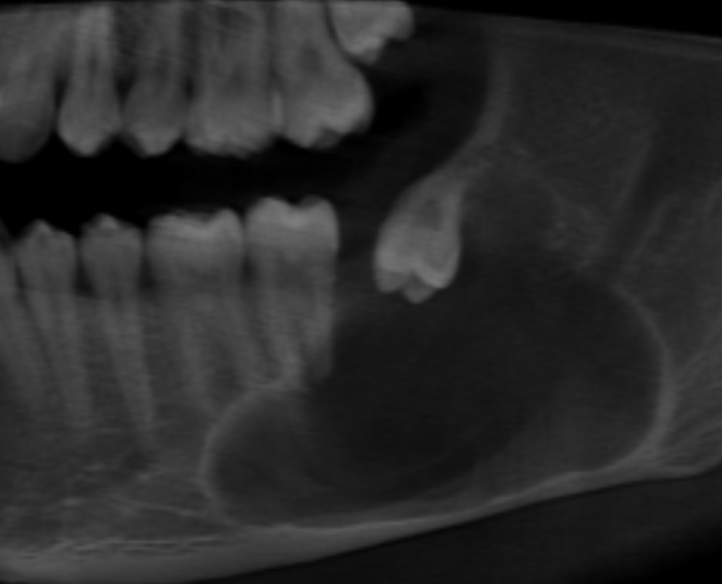 Lesion CBCT Portfolio